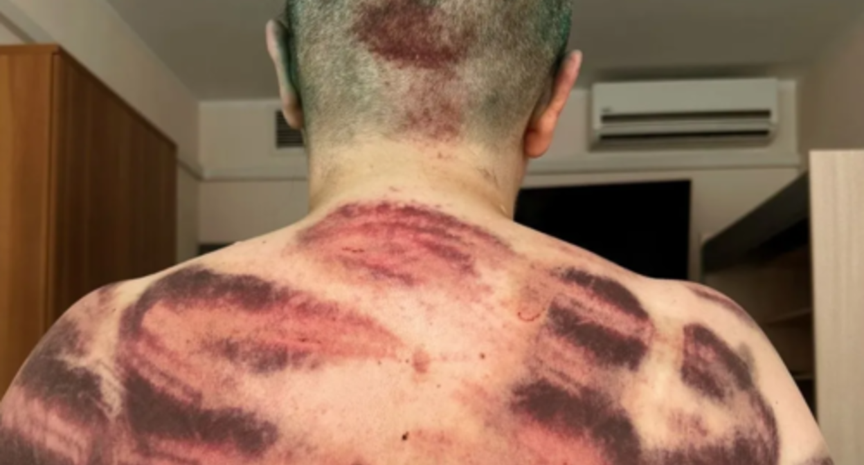 Elena Milashina, July 5, 2023. Photo: Anna Artemyeva / "Novaya Gazeta"